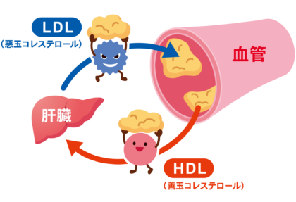 コレステロール